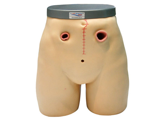 高級瘺管造口術(shù)護(hù)理模型